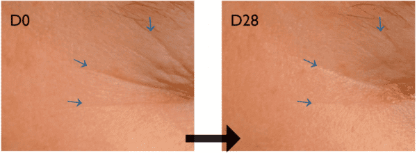 põld-lambalääts silmaümbruse kortsud - Nahrin põld-lambalääts silmaümbruse kortsud