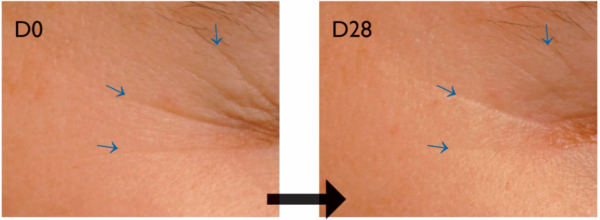 põld-lambalääts silmaümbruse kortsud - Nahrin põld-lambalääts silmaümbruse kortsud