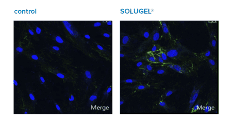 parima kollageeni pulber hüaluroonhappega - Nahrin parima kollageeni pulber hüaluroonhappega