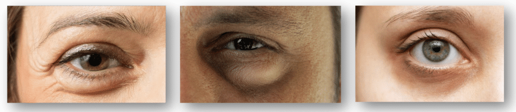 looduslik silmakreem