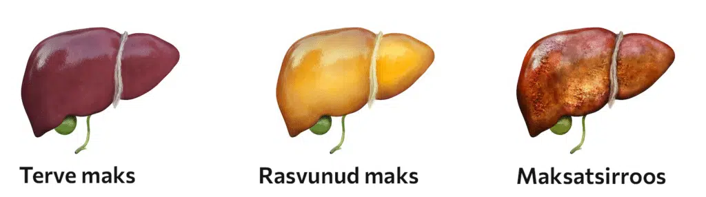 maksahaigused-copy - Nahrin choroby wątroby i oczyszczanie wątroby